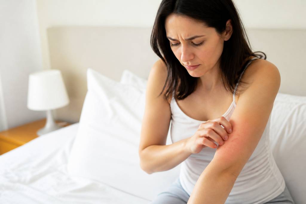Allergies punaises de lit : symptômes et solutions efficaces en région parisienne